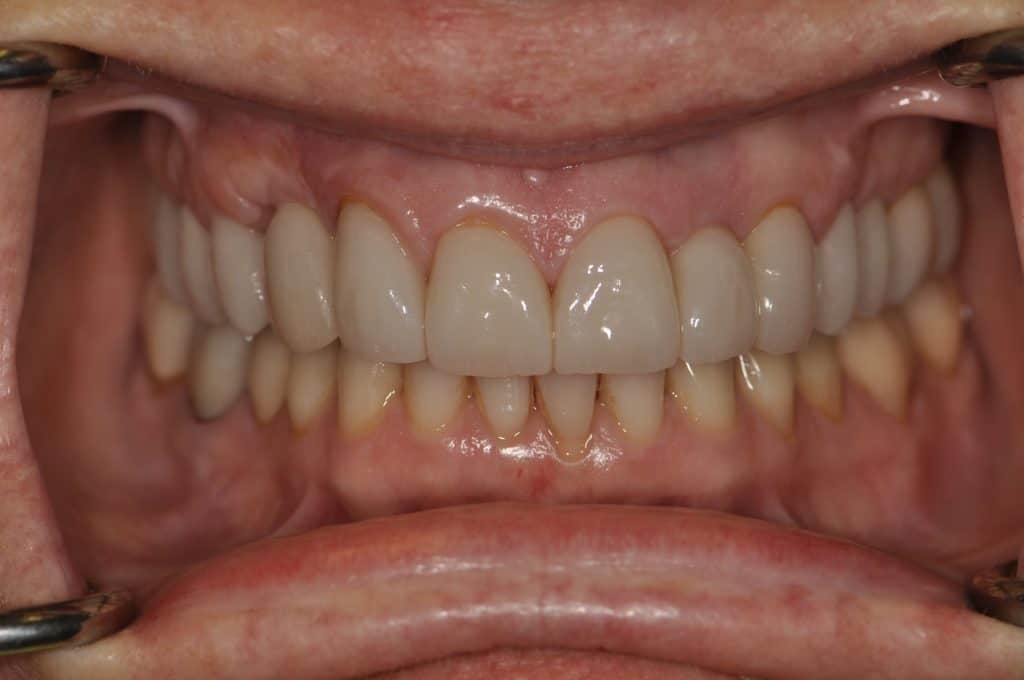 After undefined - Cosmetic Dentistry
